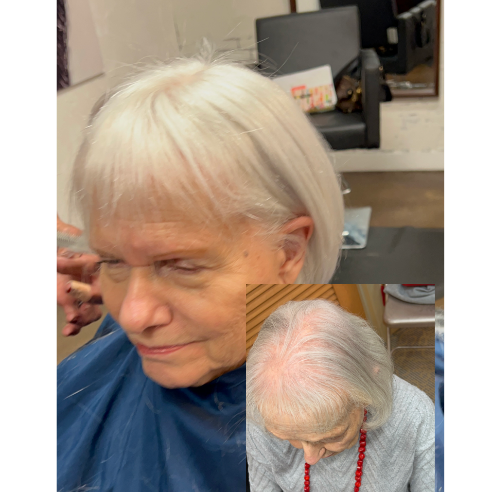 Mirge™ Crown Toppers